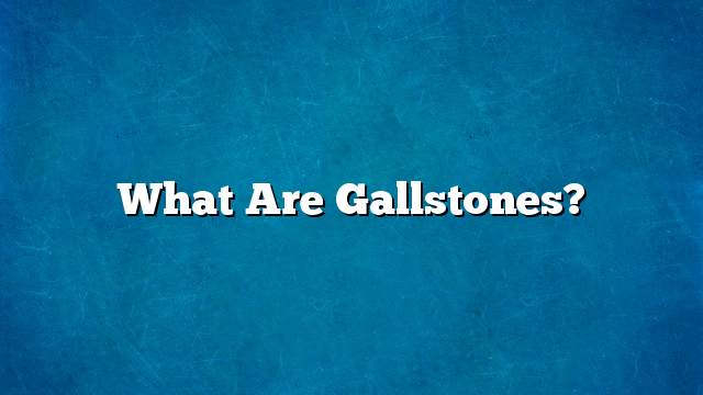 What are Gallstones?