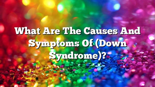 What are the causes and symptoms of (Down Syndrome)?
