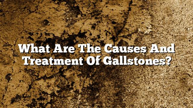 What are the causes and treatment of gallstones?