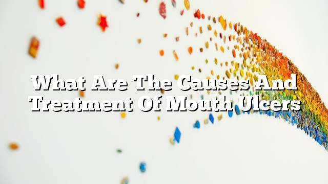 What are the causes and treatment of mouth ulcers