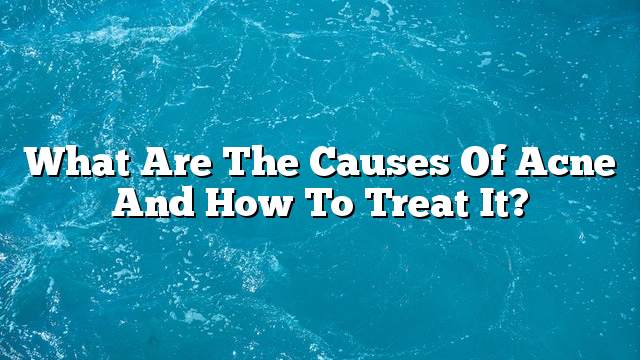 What are the causes of acne and how to treat it?