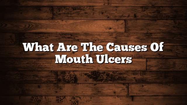 What are the causes of mouth ulcers