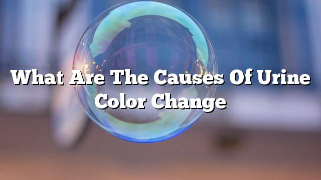 What are the causes of urine color change