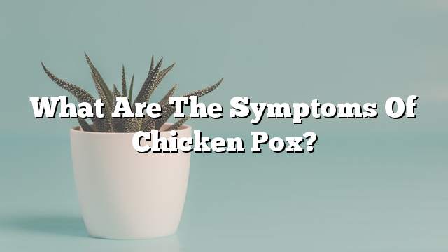 What are the symptoms of chicken pox?