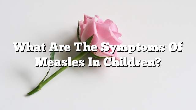 What are the symptoms of measles in children?