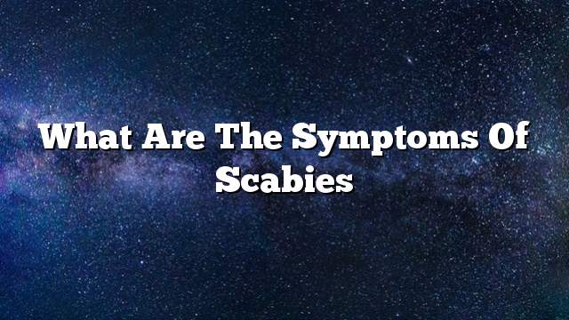 What are the symptoms of scabies