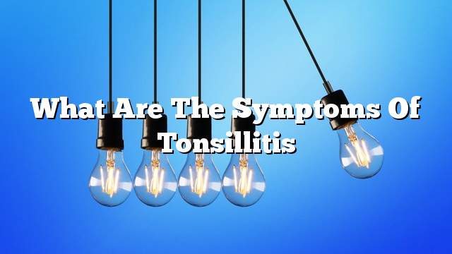 What are the symptoms of tonsillitis