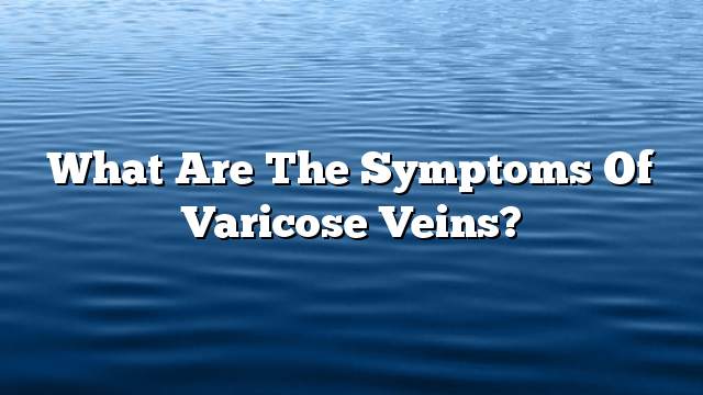 What are the symptoms of varicose veins?