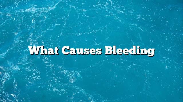 What causes bleeding