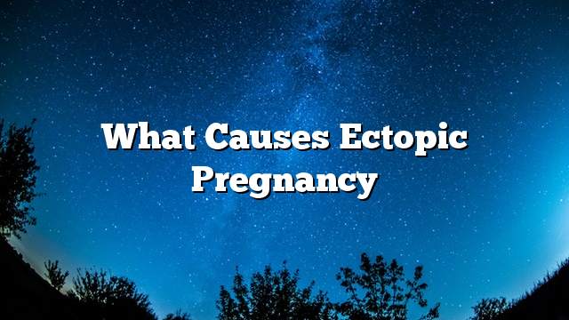 What causes ectopic pregnancy