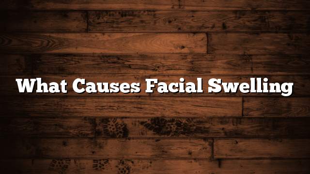 What causes facial swelling