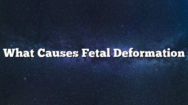 What causes fetal deformation