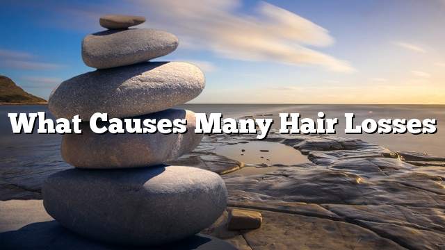 What Causes Many Hair Losses