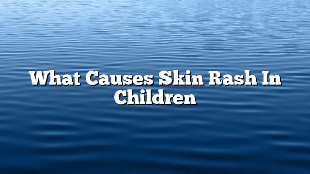 What causes skin rash in children