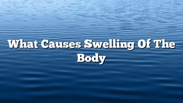 What causes swelling of the body