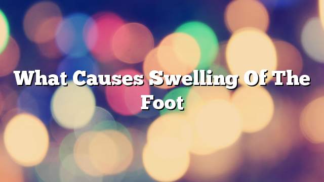 What causes swelling of the foot