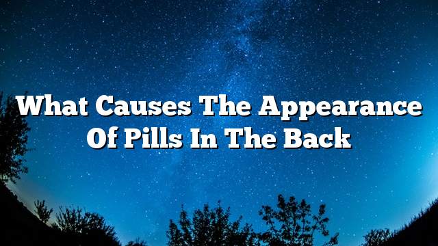 What causes the appearance of pills in the back