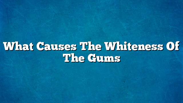 What causes the whiteness of the gums