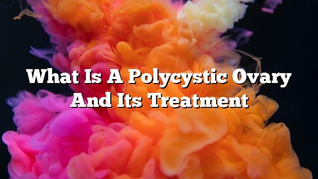 What is a polycystic ovary and its treatment