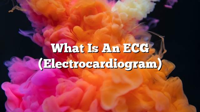 What Is an ECG (Electrocardiogram)