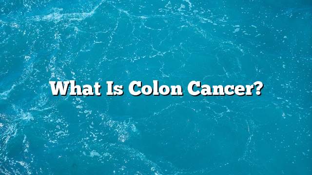 What is colon cancer?