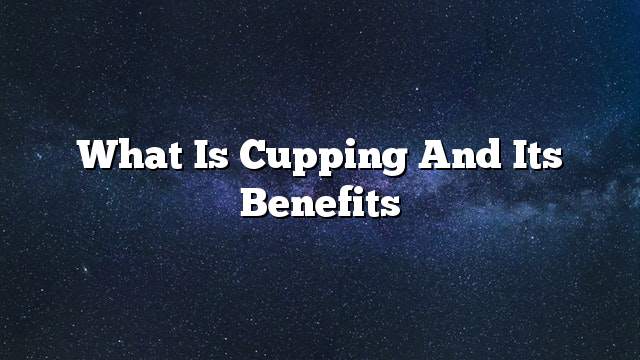 What is cupping and its benefits