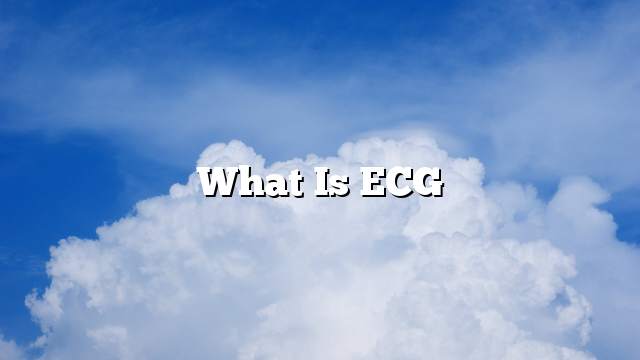 What is ECG