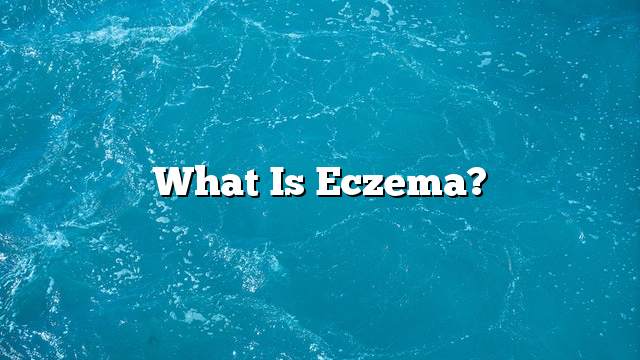 What is eczema?