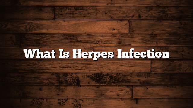 What is herpes infection