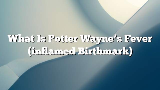 What is Potter Wayne’s fever (inflamed birthmark)