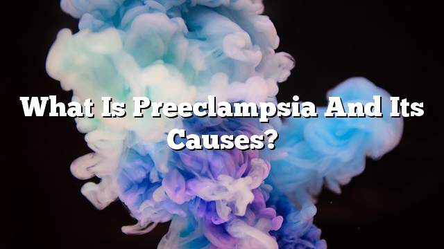 What is preeclampsia and its causes?