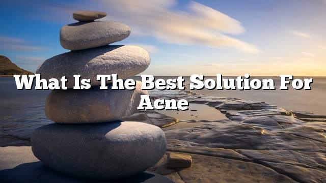 What is the best solution for acne