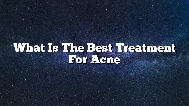 What is the best treatment for acne