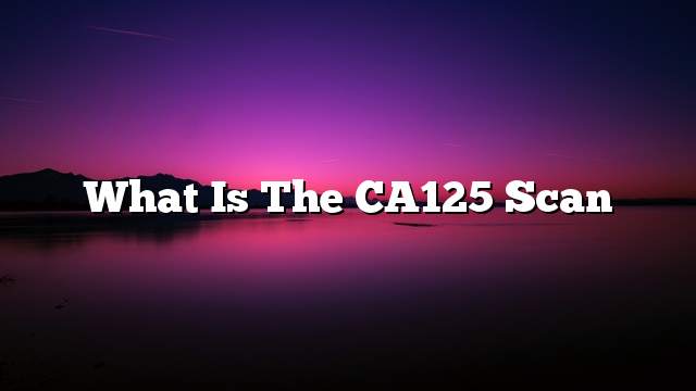 What is the CA125 scan
