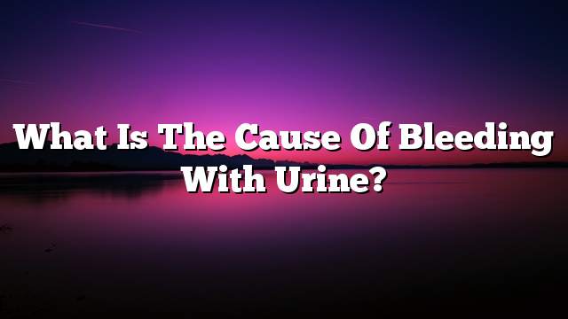 What is the cause of bleeding with urine?