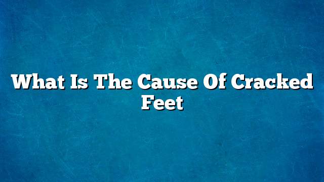 What is the cause of cracked feet