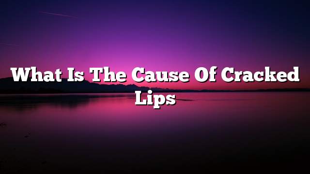 What is the cause of cracked lips