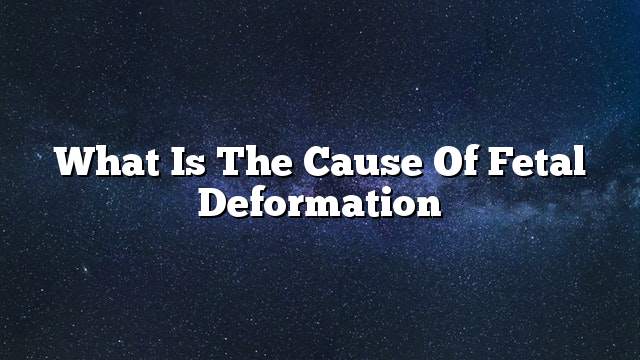 What is the cause of fetal deformation