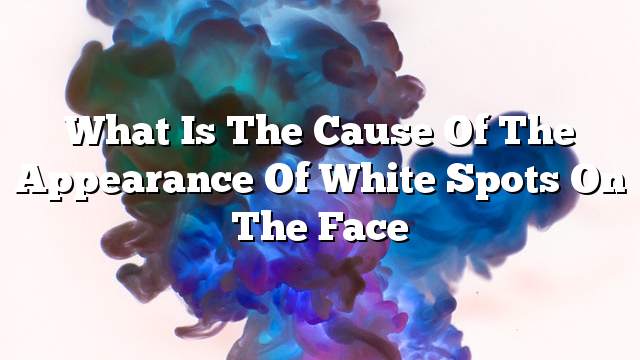 What is the cause of the appearance of white spots on the face