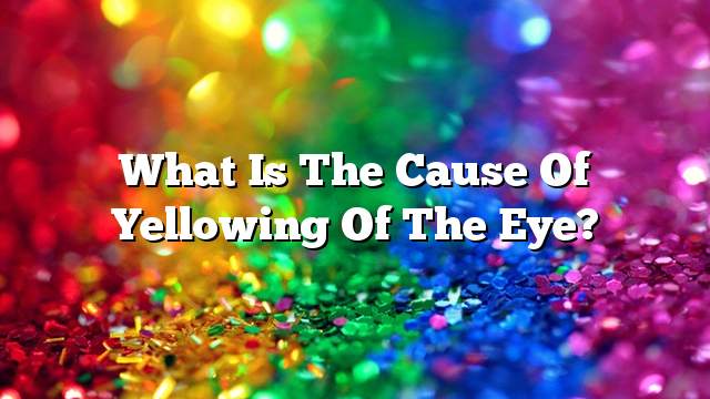 What is the cause of yellowing of the eye?