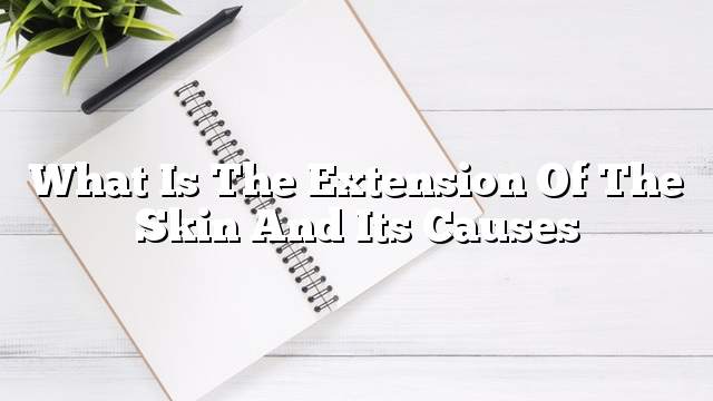 What is the extension of the skin and its causes