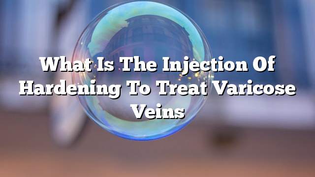 What is the injection of hardening to treat varicose veins