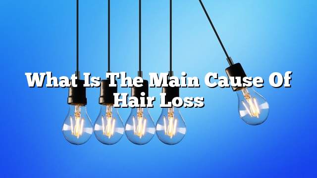 What is the main cause of hair loss