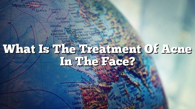 What is the treatment of acne in the face?