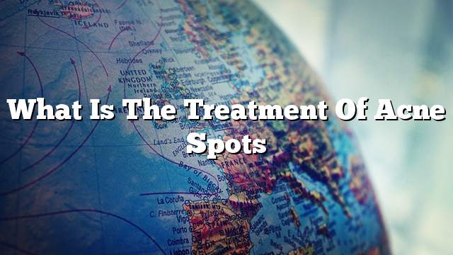 What is the treatment of acne spots