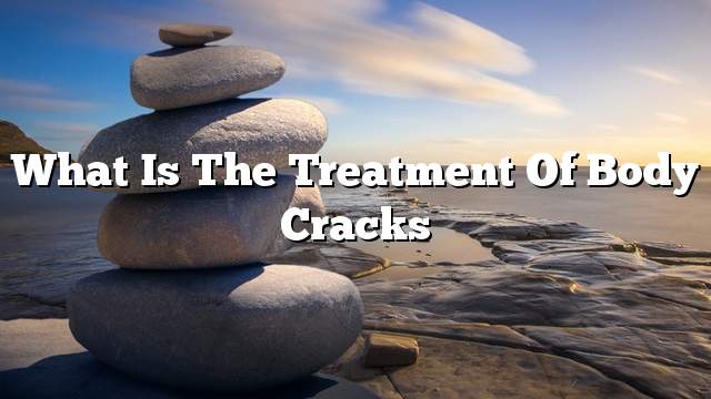 What is the treatment of body cracks