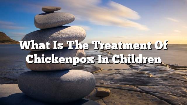 What is the treatment of chickenpox in children
