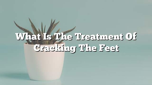 What is the treatment of cracking the feet