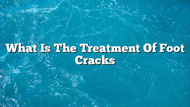 What is the treatment of foot cracks