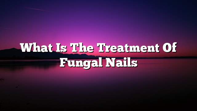 What is the treatment of fungal nails